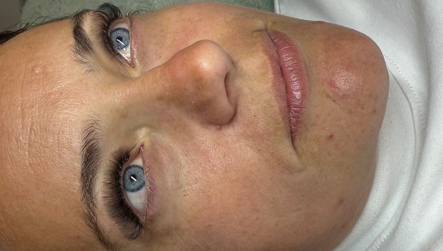 Close-up of a woman post-treatment at Muir Noir, Scarborough, England, GB, highlighting her enhanced features.