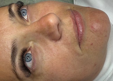 Close-up of a woman post-treatment at Muir Noir, Scarborough, England, GB, highlighting her enhanced features.