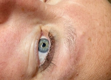 Close-up of a relaxed eye post-treatment at Muir Nior, Scarborough, England, GB showcasing smooth skin.