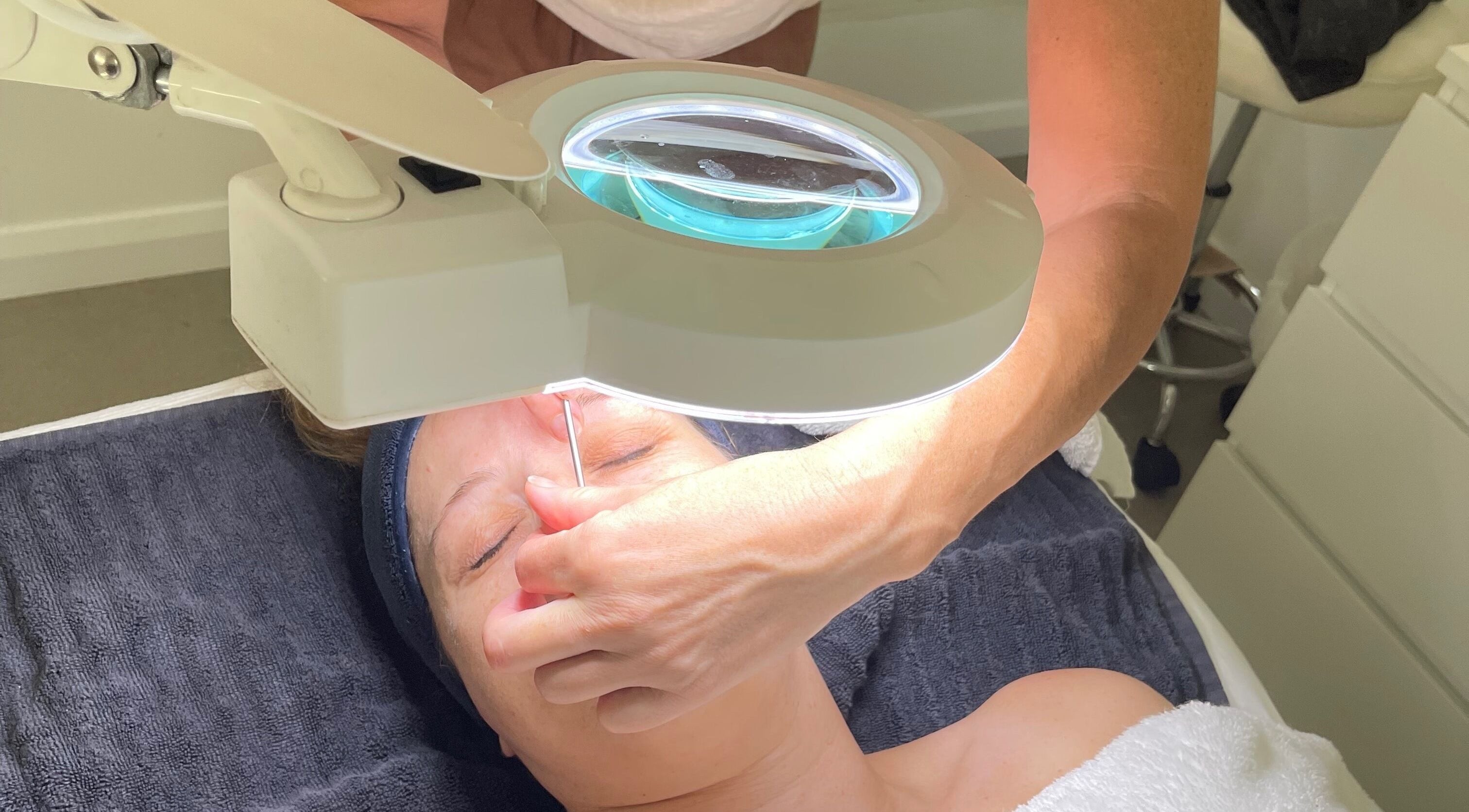 Facial treatment in progress at Derma Matrix Aesthetics, Roselands, New South Wales, AU.