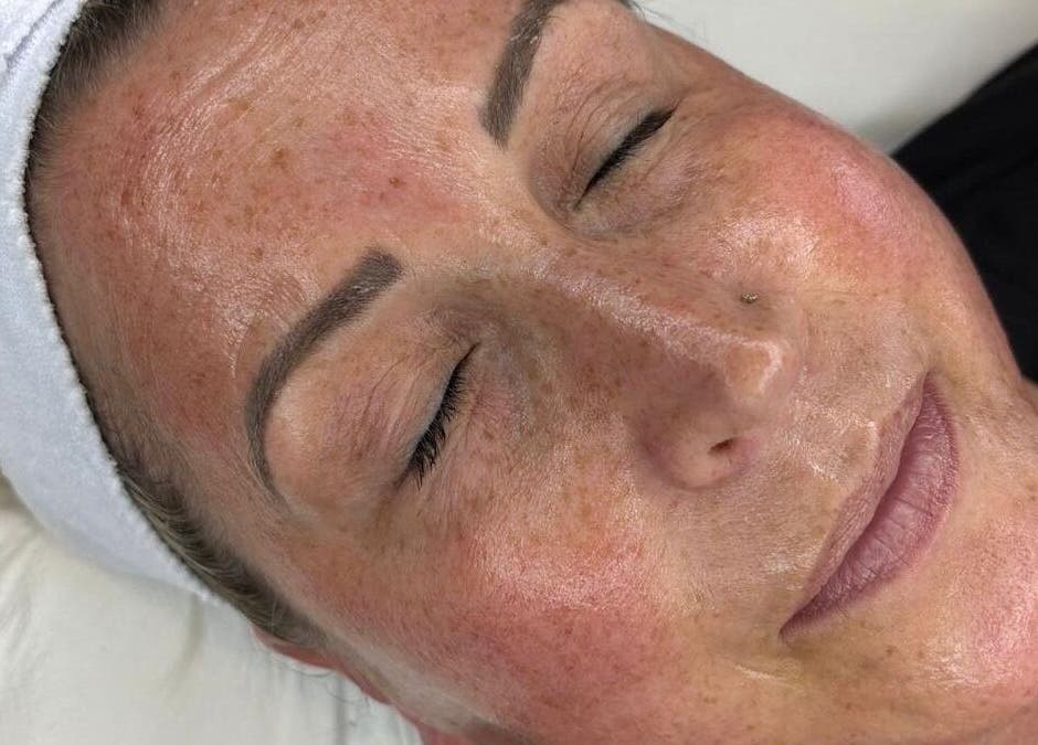 Client enjoys facial treatment at The SKN Edit, Winsford, England, GB, showcasing smooth, glowing skin.