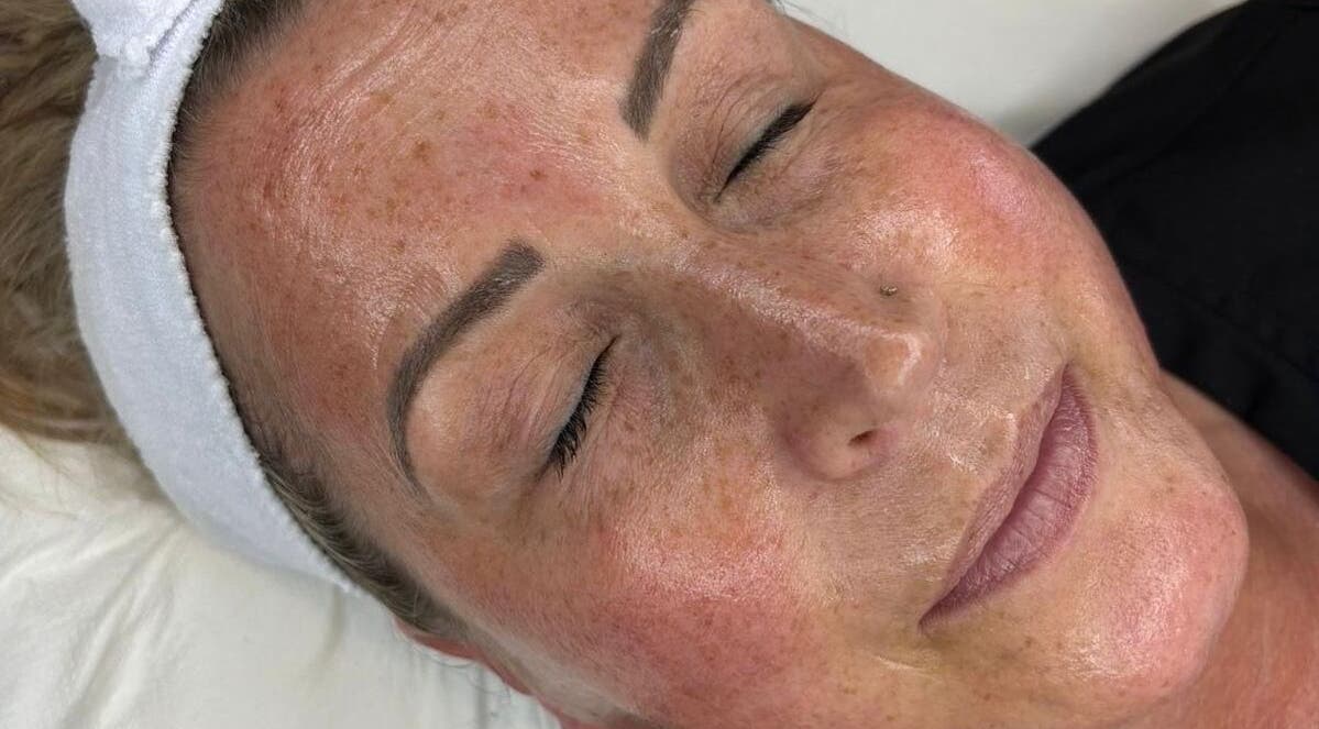 Client enjoys facial treatment at The SKN Edit, Winsford, England, GB, showcasing smooth, glowing skin.