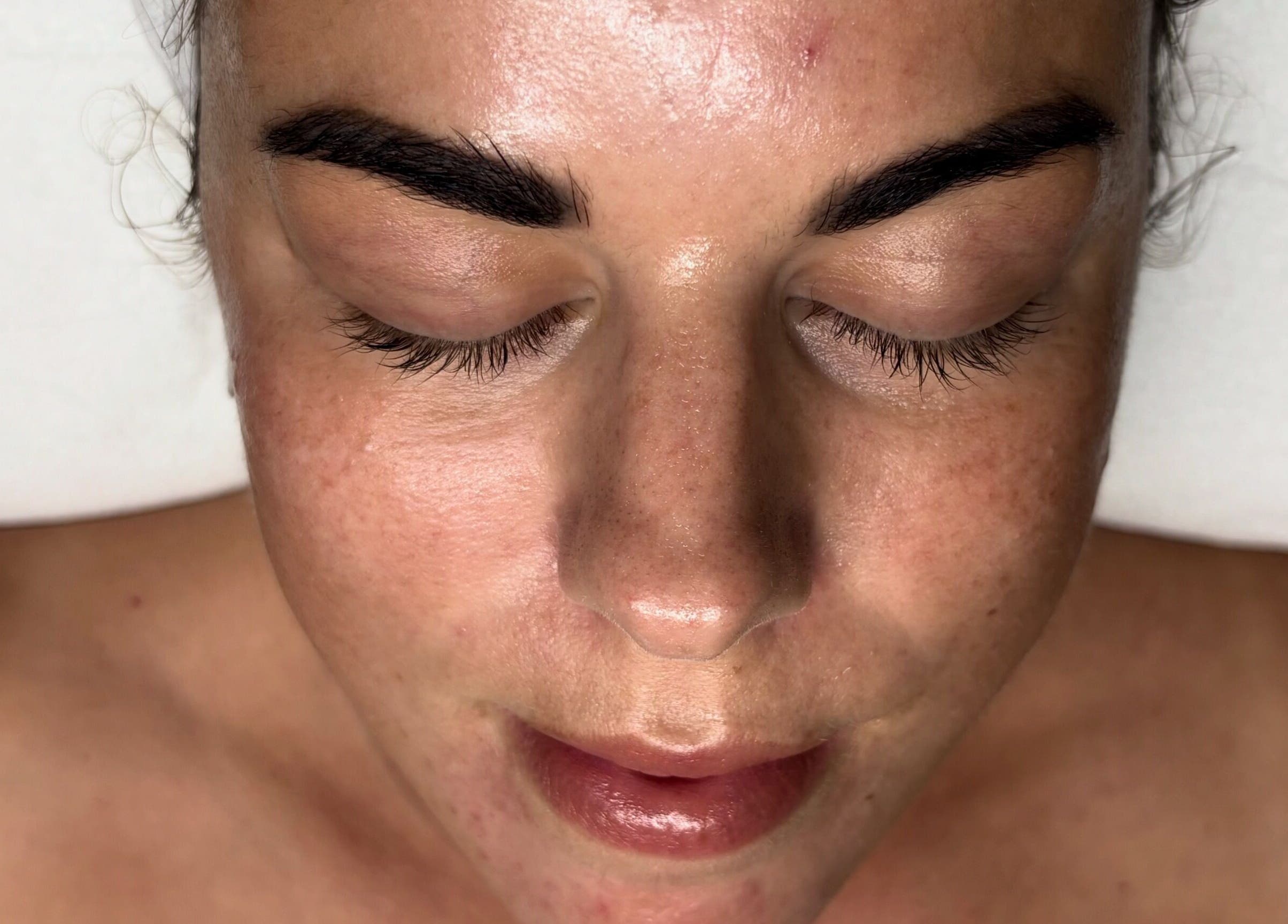 Relaxed face during facial treatment at The SKN Edit, Winsford, England, GB, enhancing natural beauty.