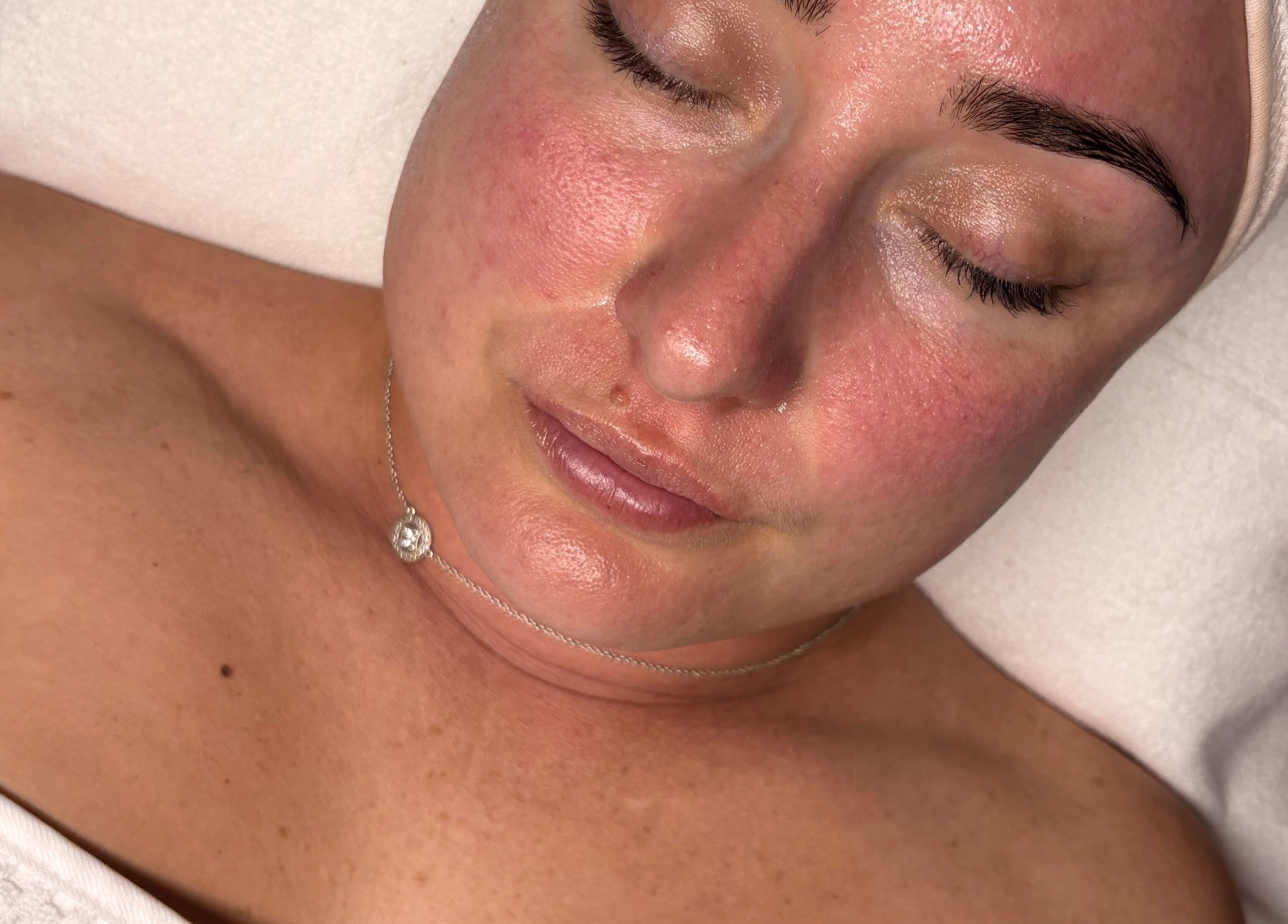Close-up of a relaxed face post-treatment at The SKN Edit, Winsford, England, GB.