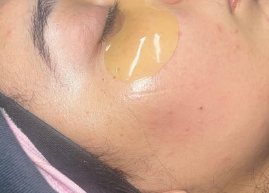 Facial treatment with gel pad at NueElleMasion, London, England, GB for radiant skin.