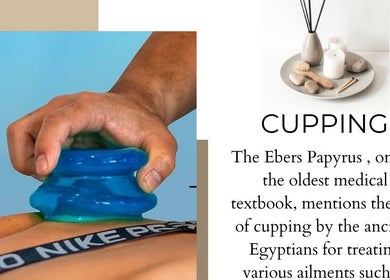 Cupping therapy at ABC Mobile Acupuncture in San Francisco, California, US showcasing an ancient healing method.
