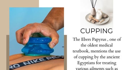 Cupping therapy at ABC Mobile Acupuncture in San Francisco, California, US showcasing an ancient healing method.