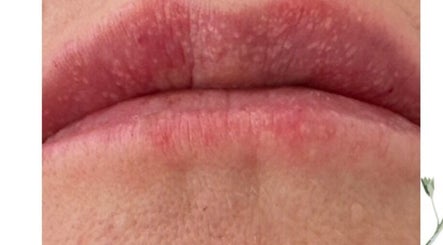 Closeup of lips illustrating skin texture at Morning Dew Health and Beauty, Sutton-in-ashfield, England, GB.
