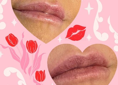 Stylish lip enhancement at Morning Dew Heath and Beauty, Sutton-in-ashfield, England, GB. Heart motifs add charm.