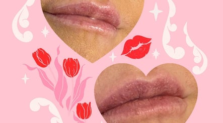 Stylish lip enhancement at Morning Dew Heath and Beauty, Sutton-in-ashfield, England, GB. Heart motifs add charm.