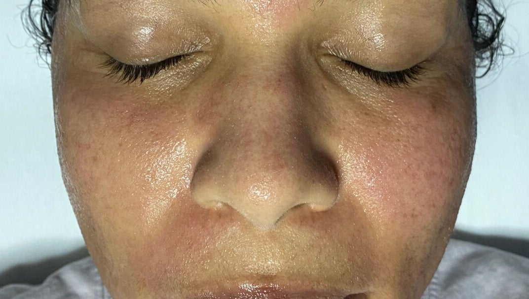 Close-up of glowing skin after a facial at Skinnin, Conway, Arkansas, US, showcasing smooth, revitalized texture.