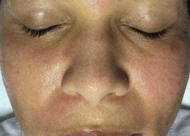 Close-up of glowing skin after a facial at Skinnin, Conway, Arkansas, US, showcasing smooth, revitalized texture.