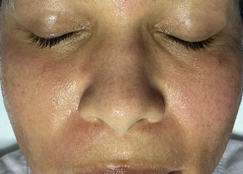 Close-up of glowing skin after a facial at Skinnin, Conway, Arkansas, US, showcasing smooth, revitalized texture.