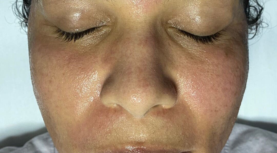 Close-up of glowing skin after a facial at Skinnin, Conway, Arkansas, US, showcasing smooth, revitalized texture.