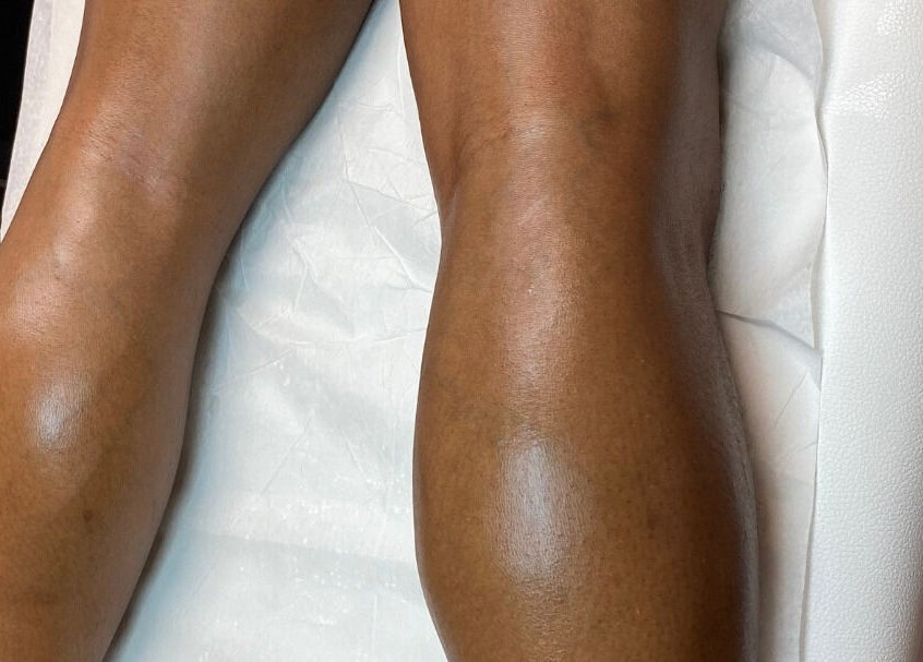 Skinnin offers revitalizing leg treatments in Conway, Arkansas, US, enhancing skin smoothness and wellness.