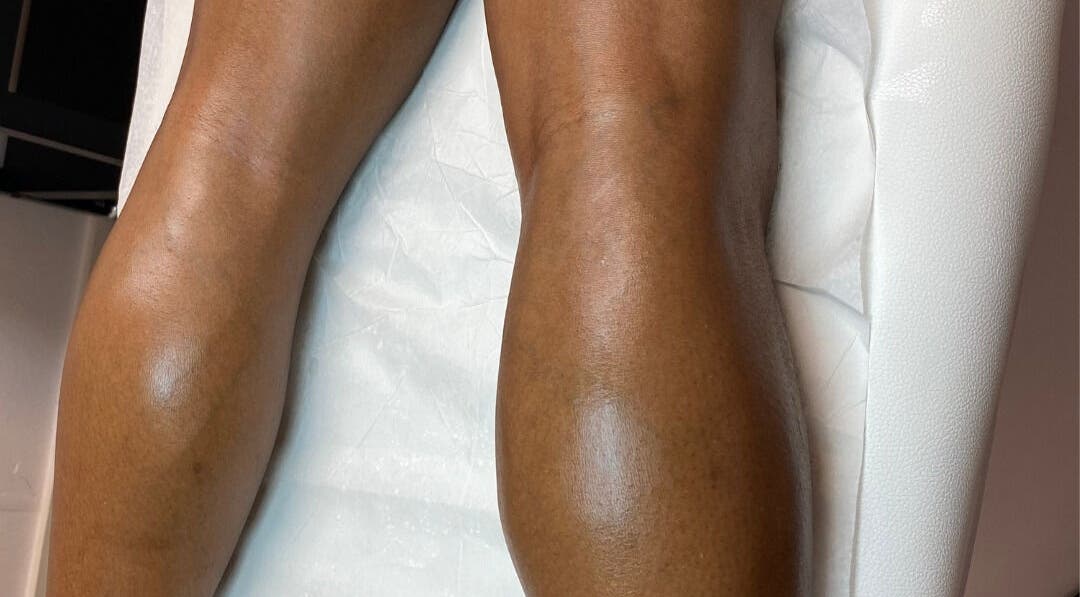 Skinnin offers revitalizing leg treatments in Conway, Arkansas, US, enhancing skin smoothness and wellness.