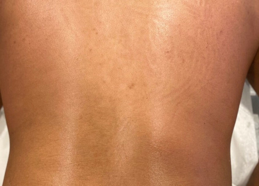 Smooth skin treatment at Skinnin in Conway, Arkansas, US. Highlighting soft, radiant results.