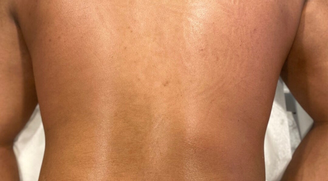 Smooth skin treatment at Skinnin in Conway, Arkansas, US. Highlighting soft, radiant results.