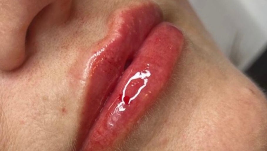 Close-up of enhanced lips at Resculpt Aesthetics, Fareham, England, GB, showcasing glossy finish.