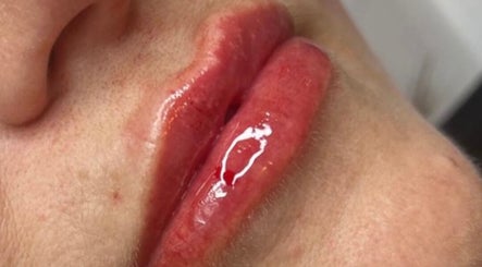Close-up of enhanced lips at Resculpt Aesthetics, Fareham, England, GB, showcasing glossy finish.