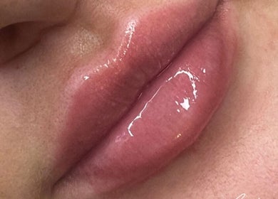 Close-up of glossy lips enhanced by Resculpt Aesthetics in Fareham, England, GB for a voluminous look.