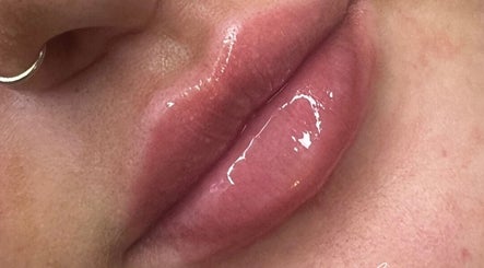 Close-up of glossy lips enhanced by Resculpt Aesthetics in Fareham, England, GB for a voluminous look.