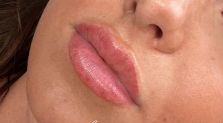 Close-up of lip enhancement at Resculpt Aesthetics, Fareham, England, GB, showcasing smooth, plump lips.