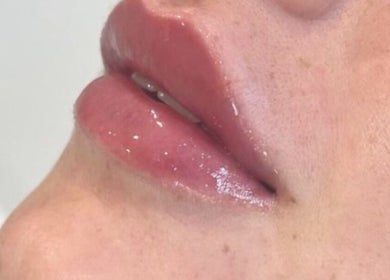 Close-up of glossy lips treated at Resculpt Aesthetics, Fareham, England, GB showcasing expert aesthetics.