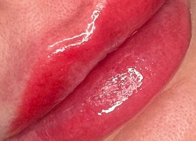 Close-up of glossy, enhanced lips at Resculpt Aesthetics, Fareham, England, GB.