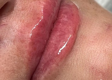 Close-up of glossy lips treated at Resculpt Aesthetics, Fareham, England, GB, showcasing professional finish.