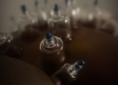 Thérapie par ventouses chez Theserenityconcept, Le Gosier, Grande-terre, GP, offrant détente et bien-être.