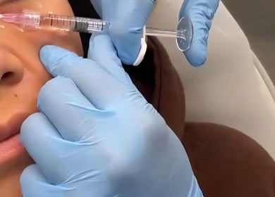Close-up of aesthetic treatment at Mae Medical Aesthetics, London, England, GB.