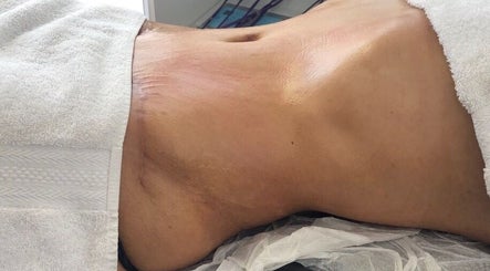 Tratamiento de abdomen en Diosas Studio Spa, Bucaramanga, Santander, CO.
