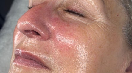 Close-up of a fresh, glowing facial treatment at Newelle Beauty in London, England, GB.