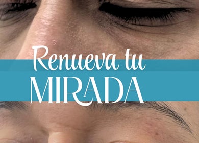 Tratamiento de rejuvenecimiento facial en Phusyon System Estética Regenerativa, Barcelona, Catalunya, ES.