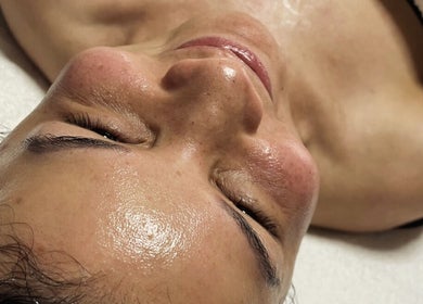 Revitalizing facial treatment at 416Skin Aesthetics & Academy in Toronto, Ontario, CA showing radiant results.