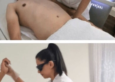 Client receiving laser treatment at Pristine Laser Clinic in Watford, England, GB for smooth skin results.