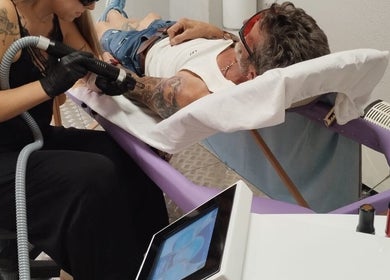 Tratamiento láser en Skin Láser, Daganzo De Arriba, Comunidad De Madrid, ES.