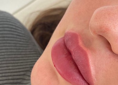 Close-up of lips showcasing beauty treatments at FaceFIT With Lauren, Inverness, Scotland, GB.