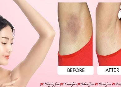Perawatan ketiak di Pearl Beauty Studio, Nusa Tenggara Timur, menunjukkan hasil sebelum dan sesudah.