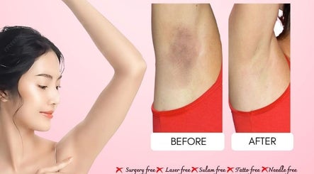 Perawatan ketiak di Pearl Beauty Studio, Nusa Tenggara Timur, menunjukkan hasil sebelum dan sesudah.