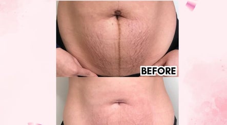 Hasil sebelum dan sesudah perawatan kulit di Pearl Beauty Studio, Nusa Tenggara Timur. Kesan mengesankan.