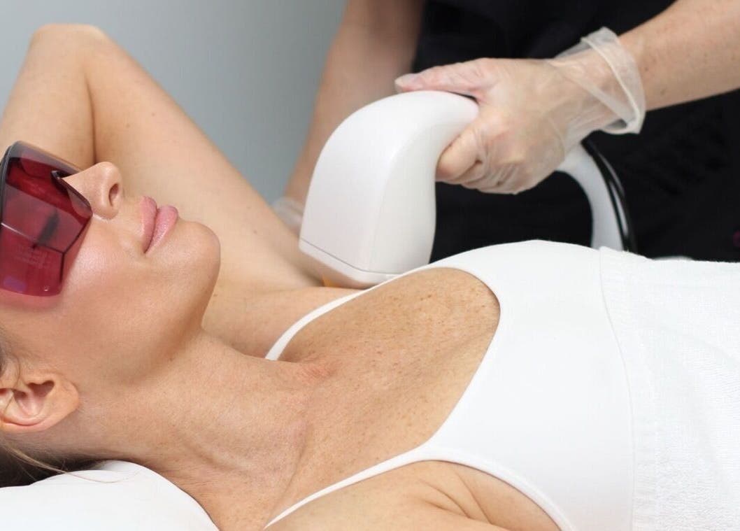 Laser hair removal at RayanBeautyy - Ottawa, offering precise treatments in Ottawa, Ontario, CA.