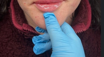 Close-up of lip enhancement procedure at Kr House Of Aesthetics, Dundee, Scotland, GB.