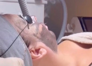 Client receiving skin treatment at Lumina - Tattoo & Hair Removal, Bussum, Noord-holland, NL.