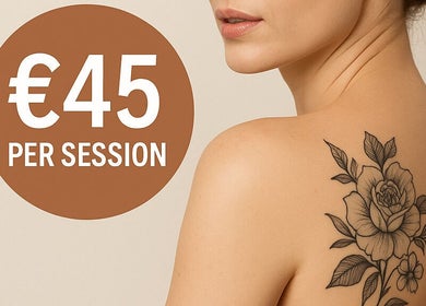 Tattoo removal offer at Lumina - Tattoo & Hair Removal, Bussum, Noord-holland, NL. Floral tattoo on a shoulder.