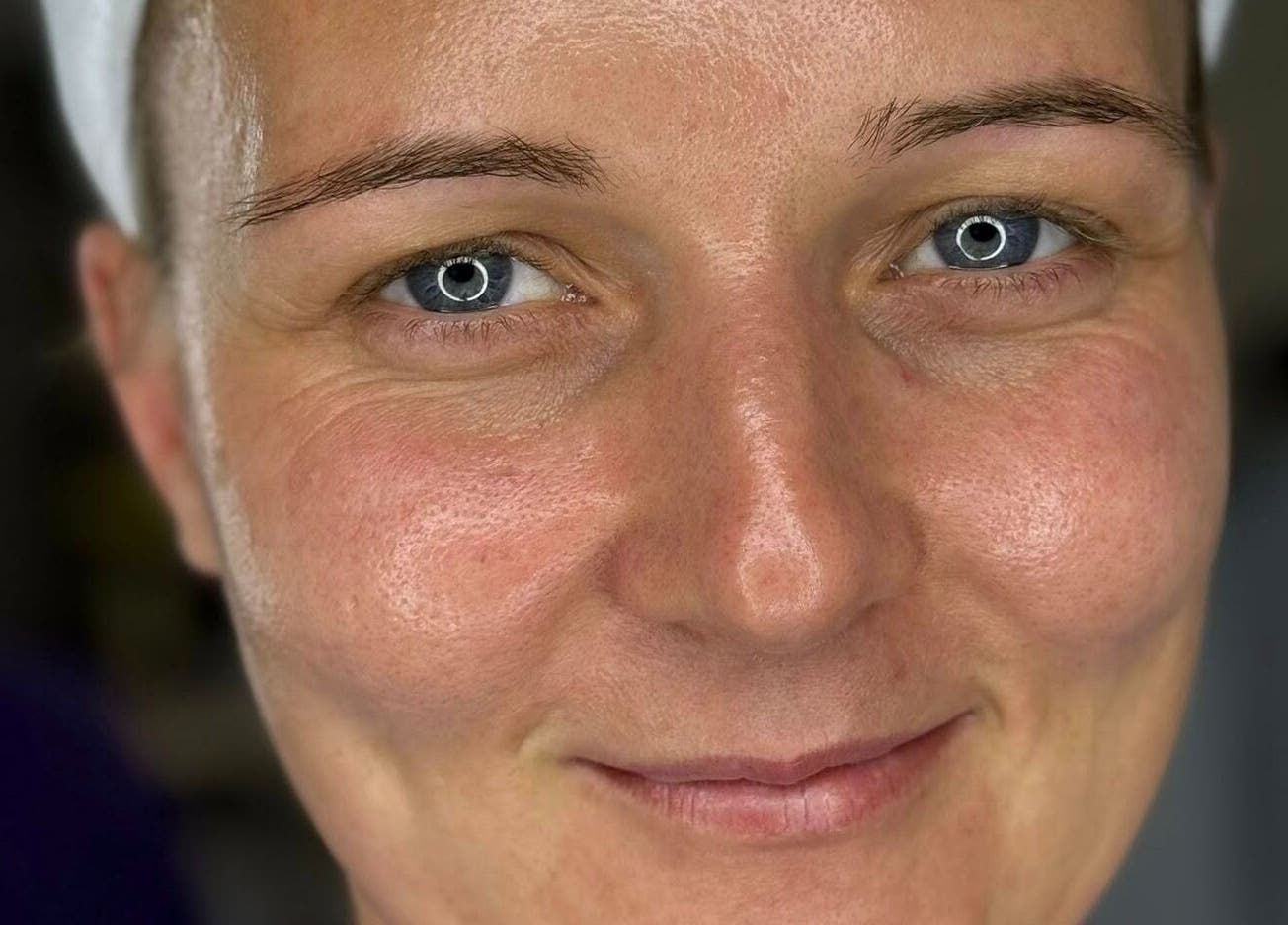 Close-up of clear skin at Vision Aesthetics and Skin, Chesterfield, England, GB.