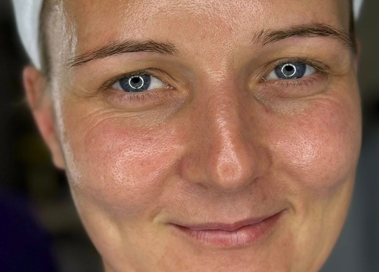 Close-up of clear skin at Vision Aesthetics and Skin, Chesterfield, England, GB.