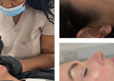 Aesthetic treatment at Nu Face Clinic, Worsley, England. Focus on skilled hands applying a precise injection.