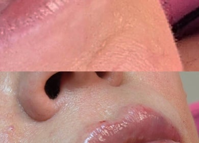 Close-up of glossy lips after a beauty treatment at Nu Face Clinic, Worsley, England, GB.